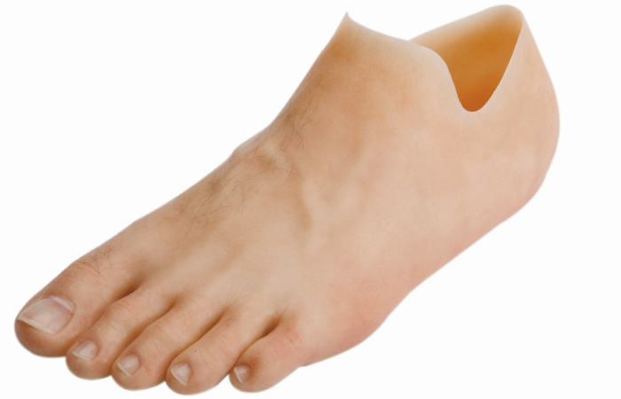 Custom silicone partial foot prosthesis and toe prosthesis